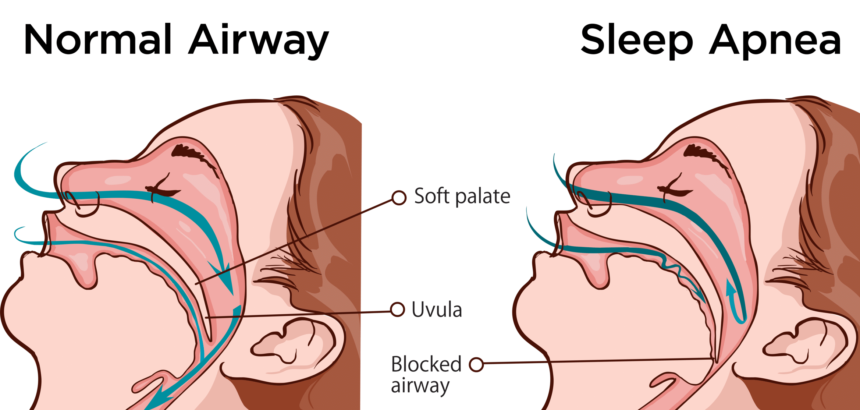 Why Do I Drool When I Sleep? What's the Cause and What to Do?