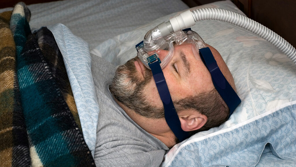 Best CPAP Mask for Beards: Only Good Nights