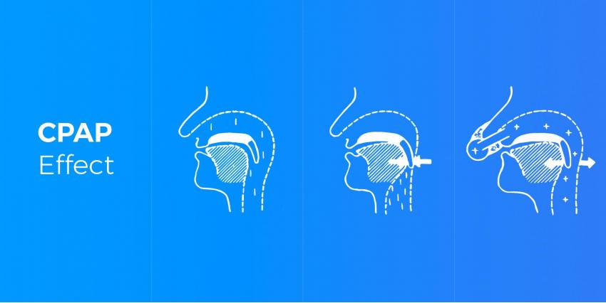 CPAP vs. BiPAP: Which One Do You Need?